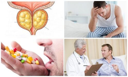 პროსტატიტი მამაკაცებში